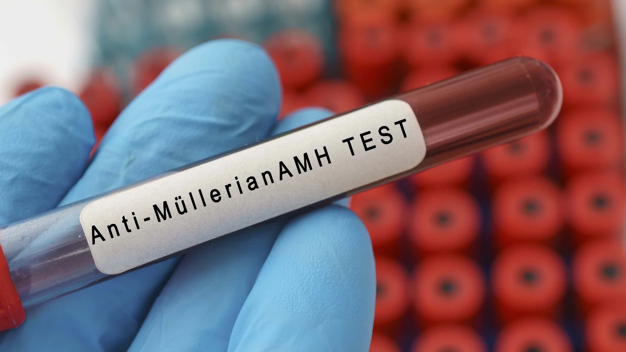 AMH Test in Noida Laboratory at Anaya IVF & Fertility Care