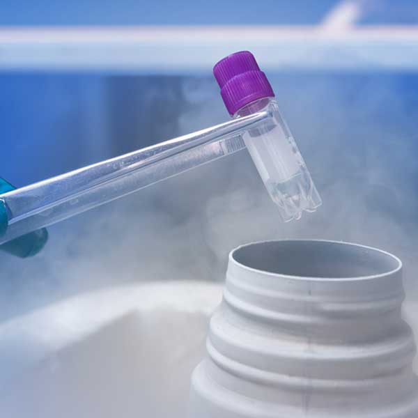 Eggs & Embryo Freezing Treatment in Noida Process