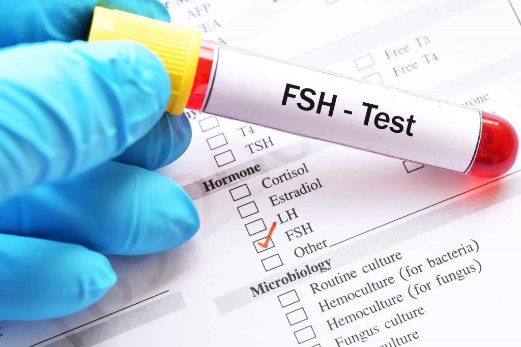  FSH (Follicle Stimulating Hormone Estradiol) Test in Noida - Anaya IVF & Fertility Care