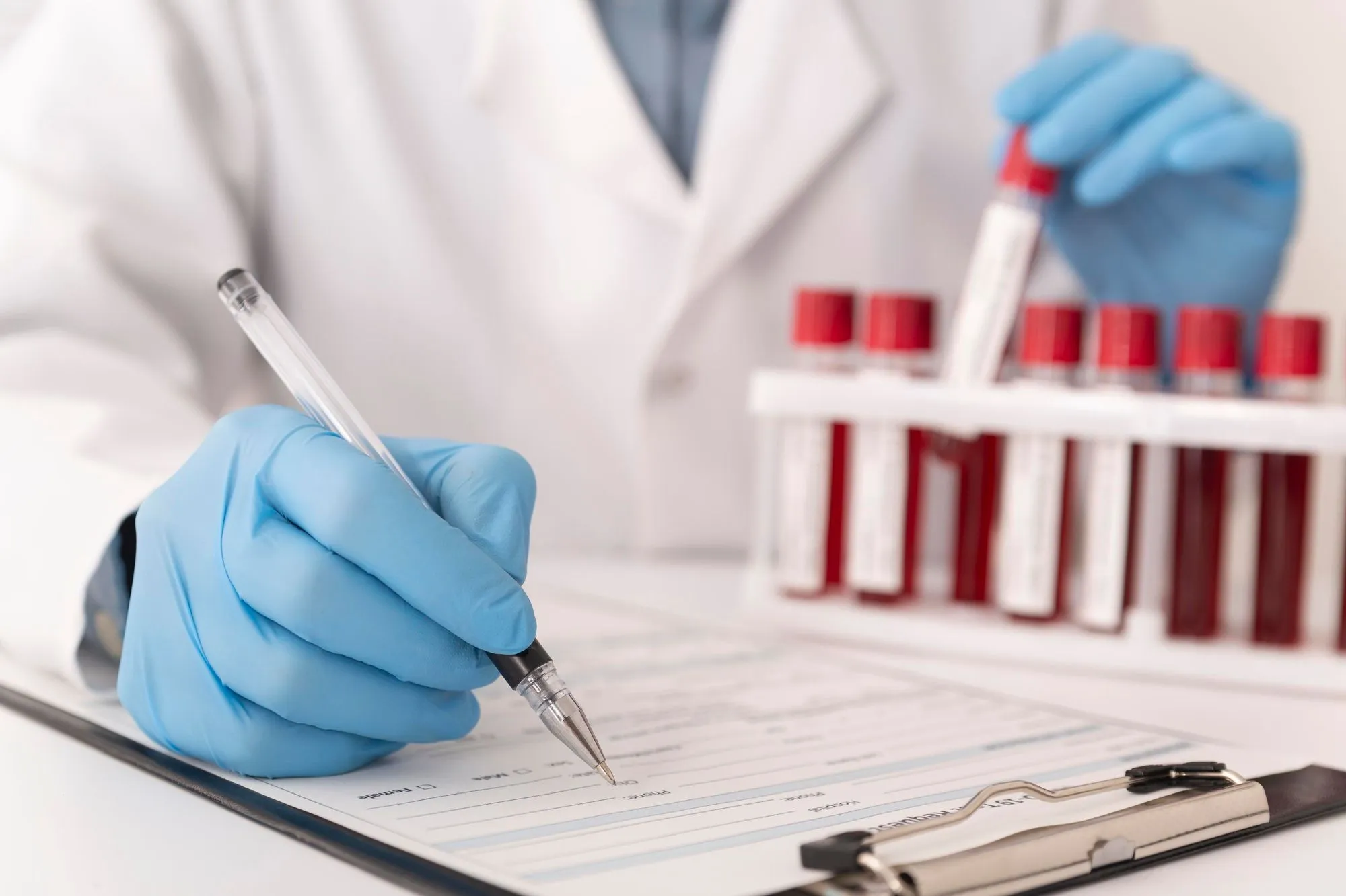 FSH & Estradiol Test in Noida Process