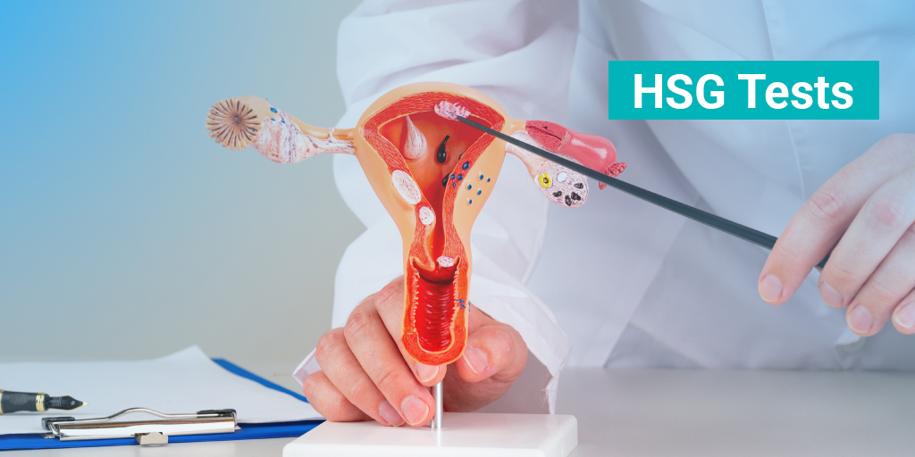 HSG Tube Test in Noida - Anaya IVF & Fertility Care