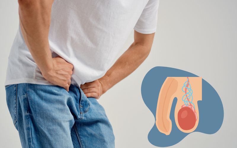 Varicocele Treatment in Noida - Anaya IVF & Fertility Care